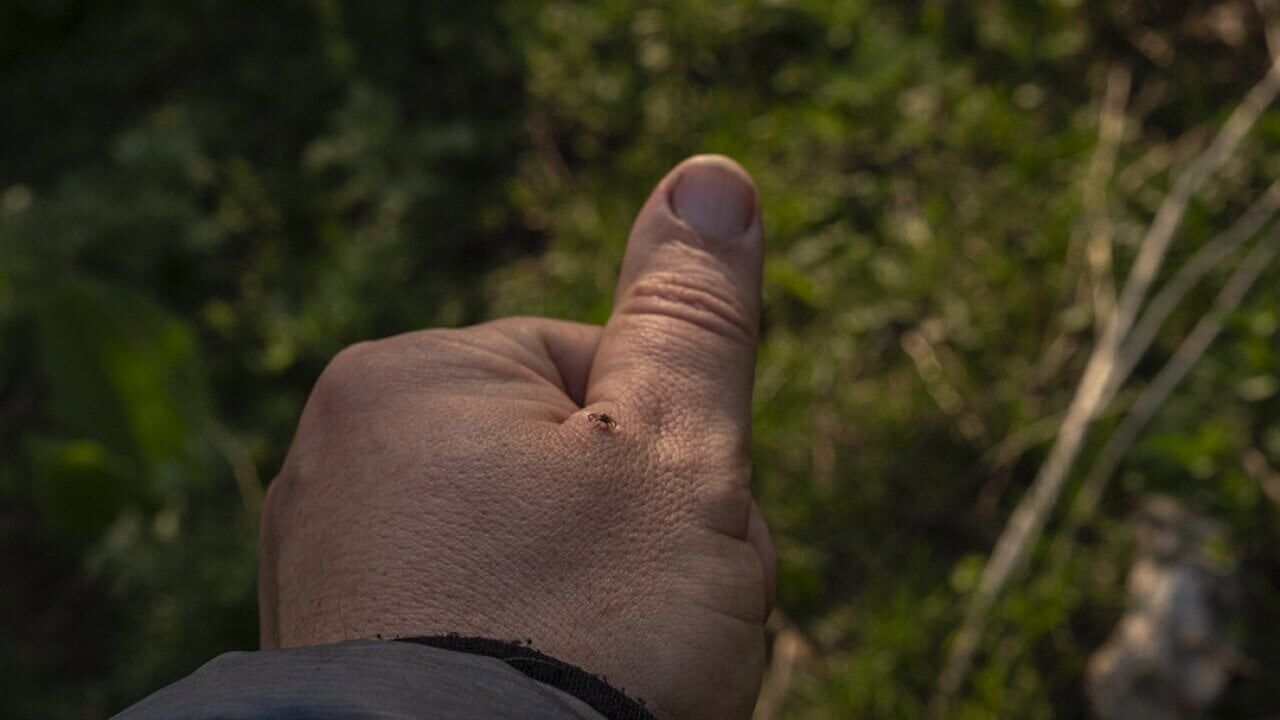 Warmer temps bring soaring tick populations. Here’s how to stay safe from Lyme disease