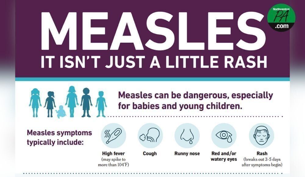 cdc measles 2025