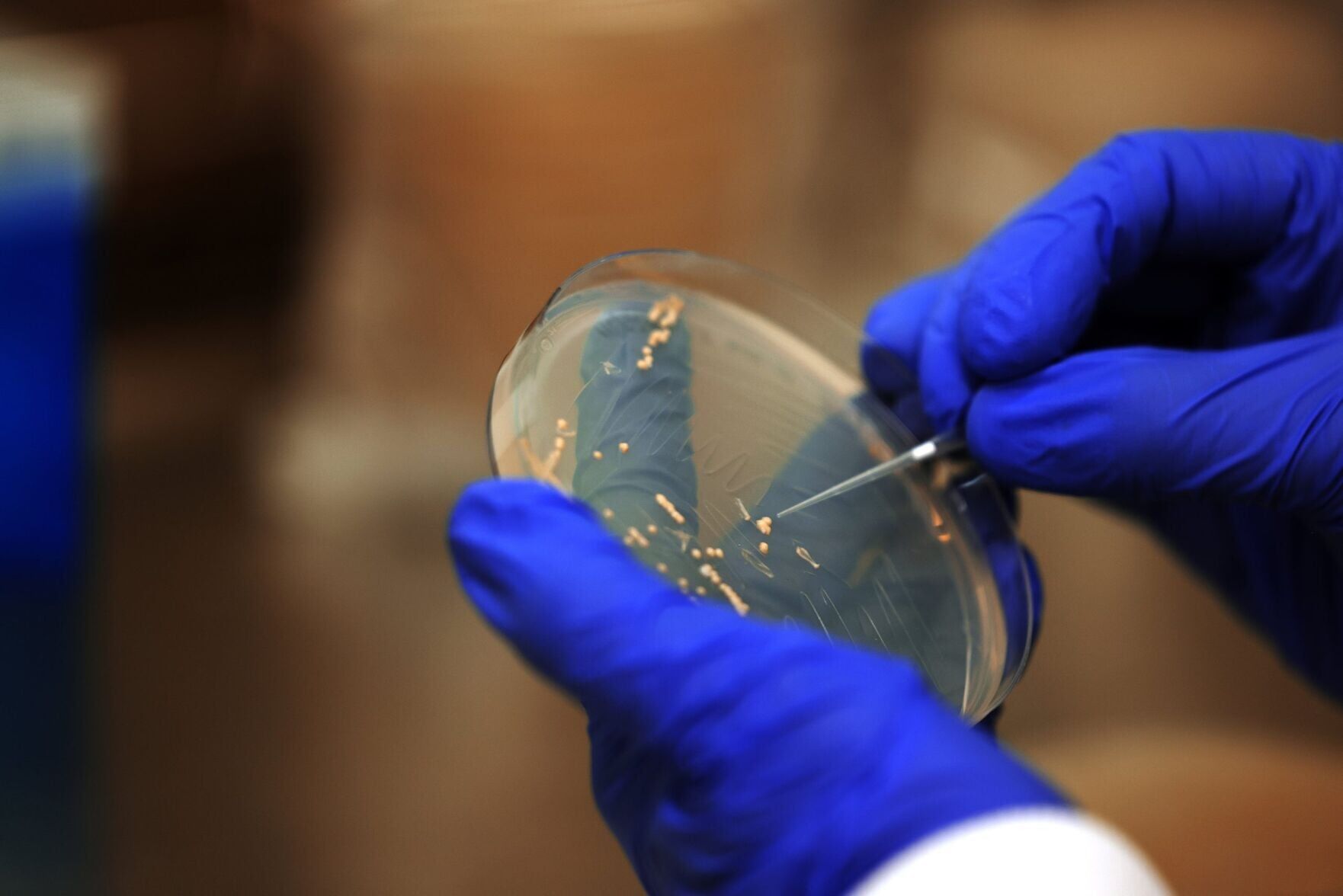Universal flu vaccine derived from yeast could replace annual jabs, suggests study