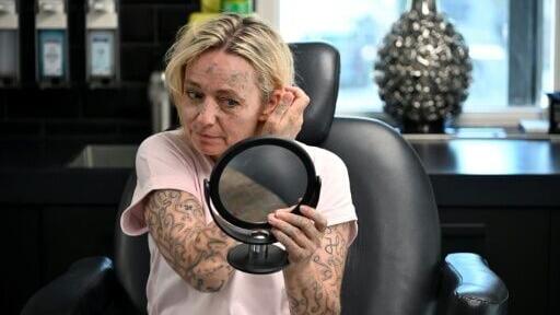 The tattoos are now barely visible under make-up