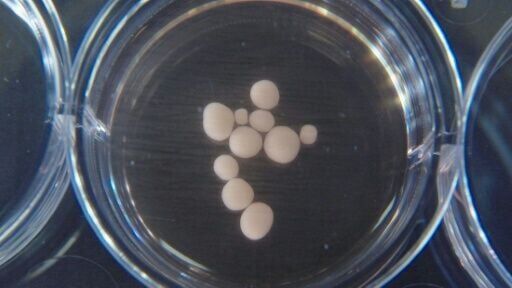 Scientists hope brain organoids can reveal information about our mysterious brains -- and help test new drugs