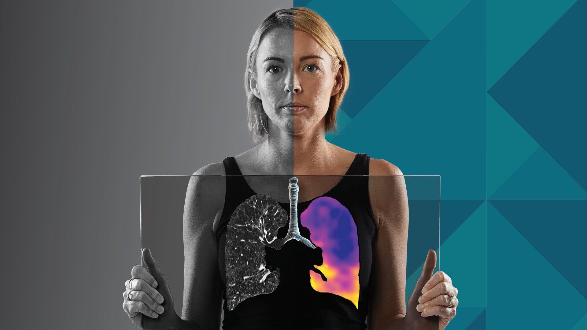 Australia becomes the latest market to grant regulatory approval for 4DMedical’s CT:VQ.