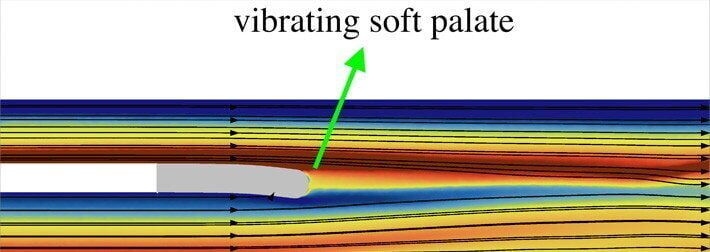 Loud snoring could be reduced thanks to high tech breakthrough