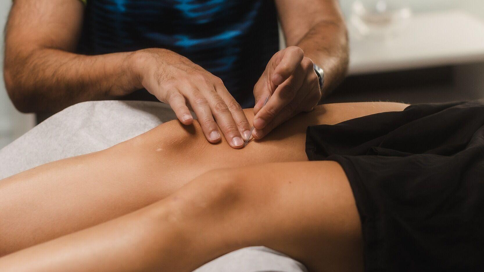 Dry needling treatment for runners at Morningside Acupuncture in New York City. 

Photo credit: Keith Montero (@keefshoots)