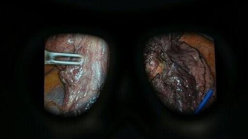 The government has set a target for robotic assistance to be used in 9 out of 10 keyhole surgeries in England by 2035