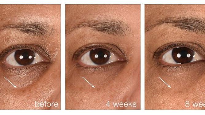 Rebuild Hollow Undereyes by 129%* with Smart Eye Density