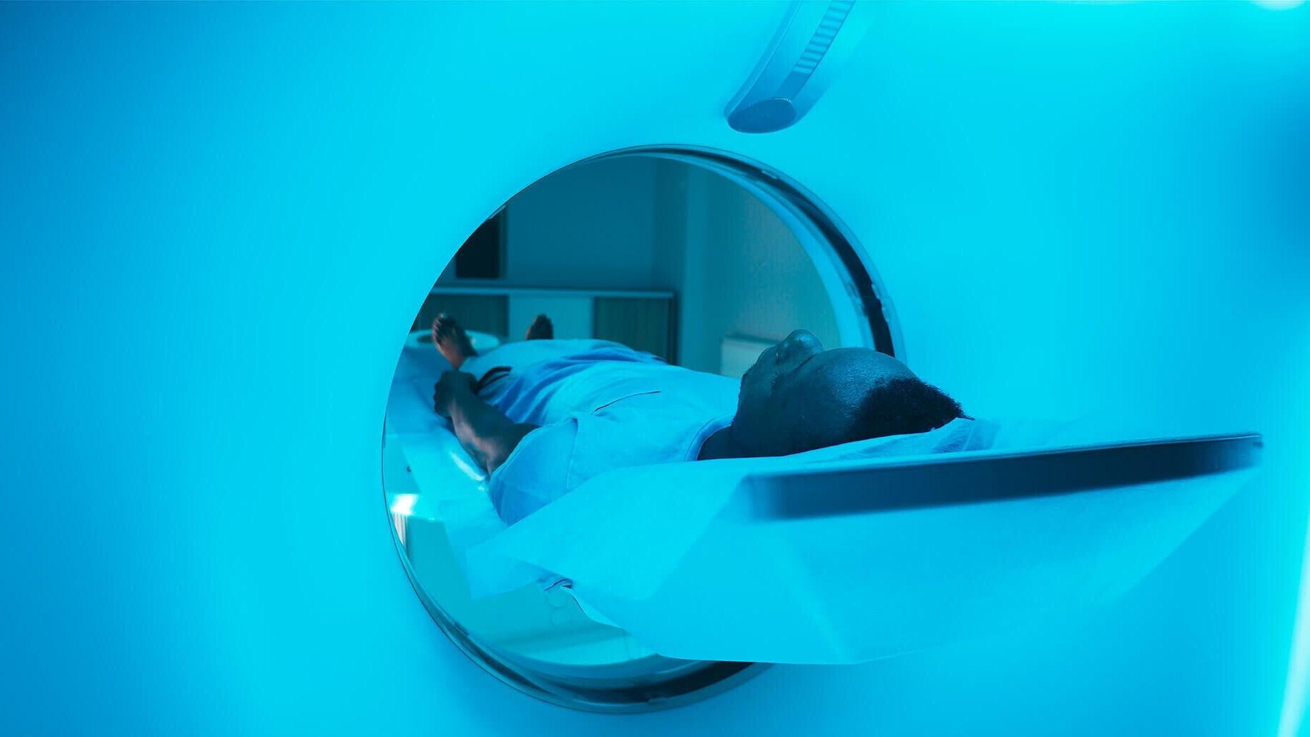 Cochlear Nucleus implants (CI1000 Nexa and CI600) are designed to support routine access to MRI at commonly used strengths (1.5T and 3.0T) without magnet removal.