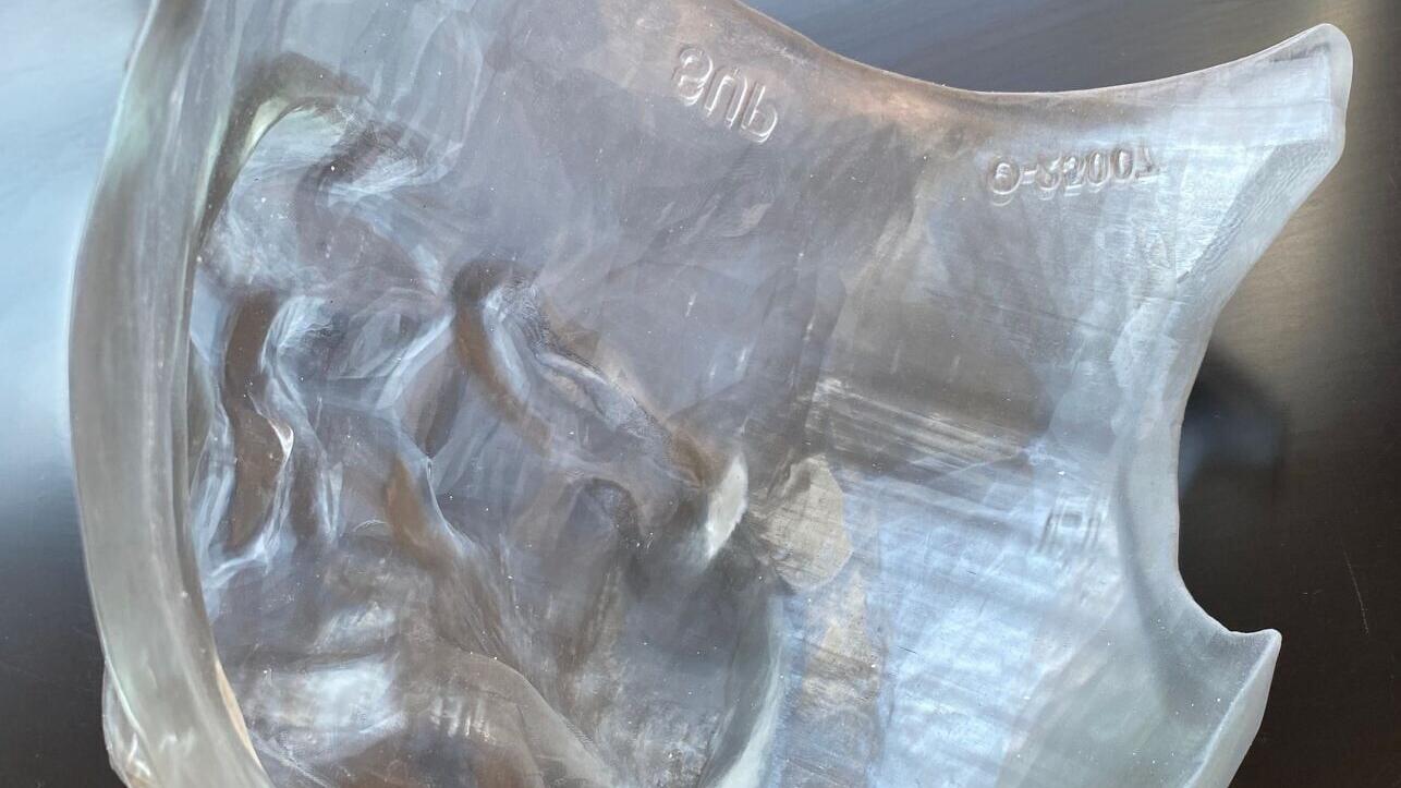 Myrava patient-specific 3D printed bolus